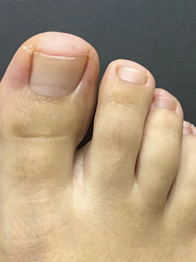 After photo of James A, 52