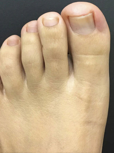 After photo of Emily A, 45