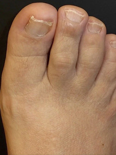 After photo of James A, 52