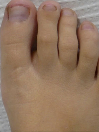 After photo of Jessica L, 52
