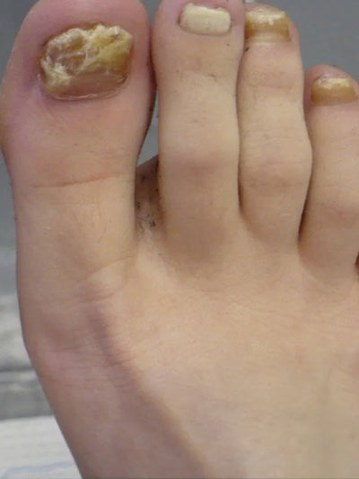 Before photo of Jessica L, 52