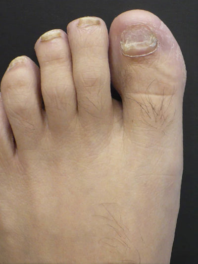 Before photo of William S, 42